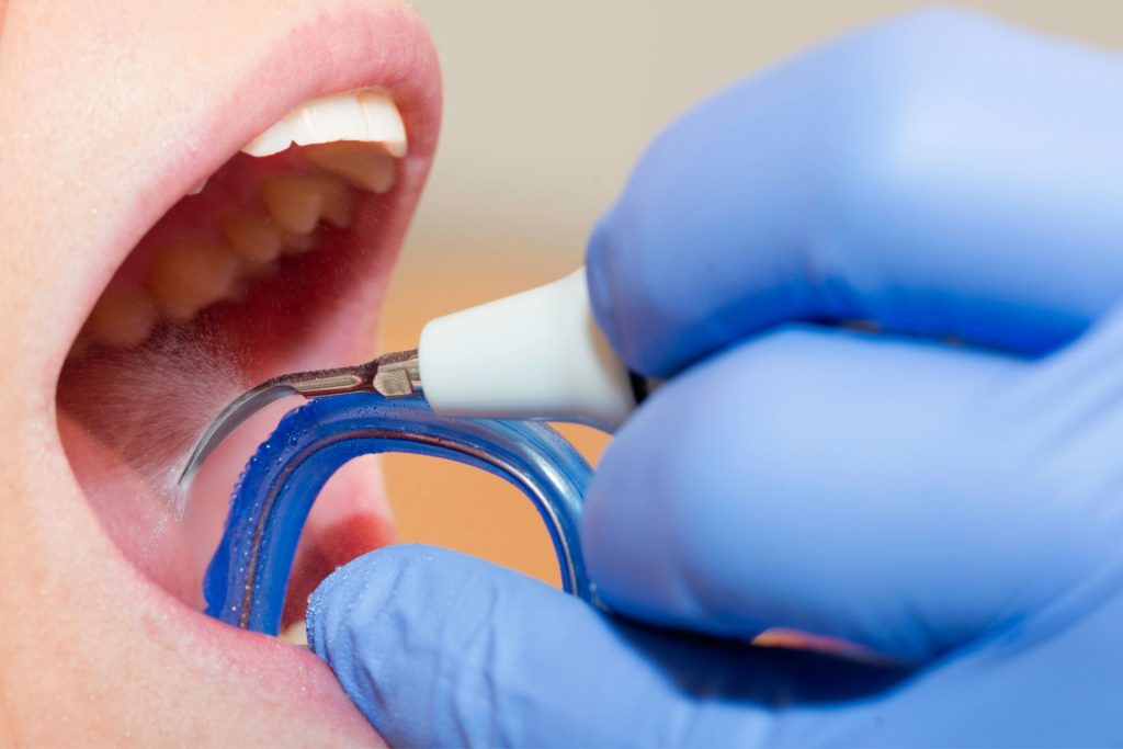 Higiene Dental