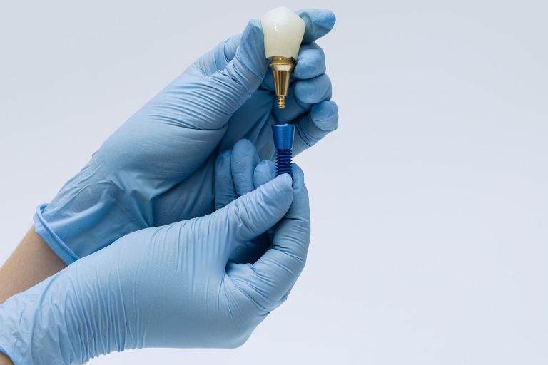 Implante Ms Dental