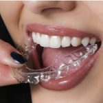 Contención Estética