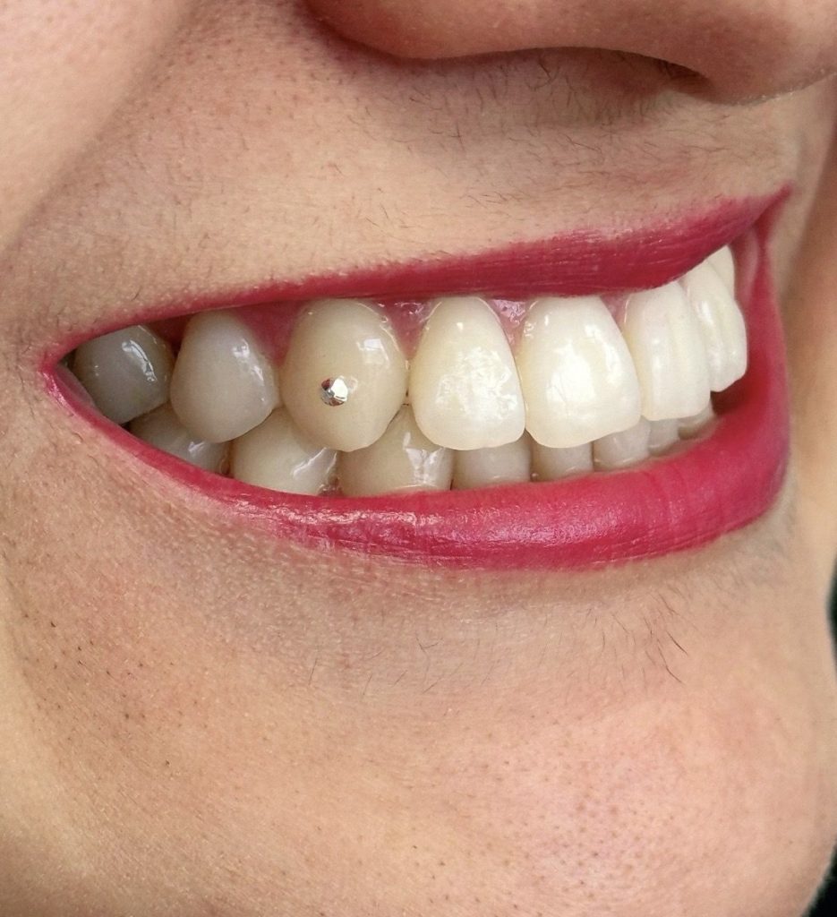 Piercing dental providencia