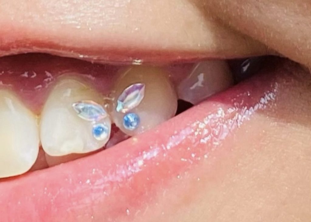 piercing dental providencia